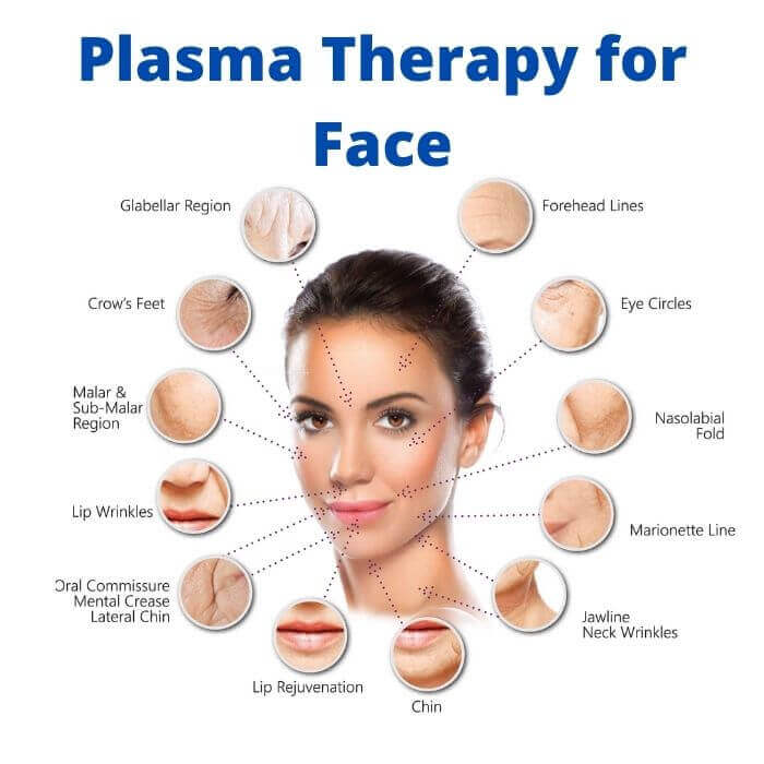 Plasma Therapy